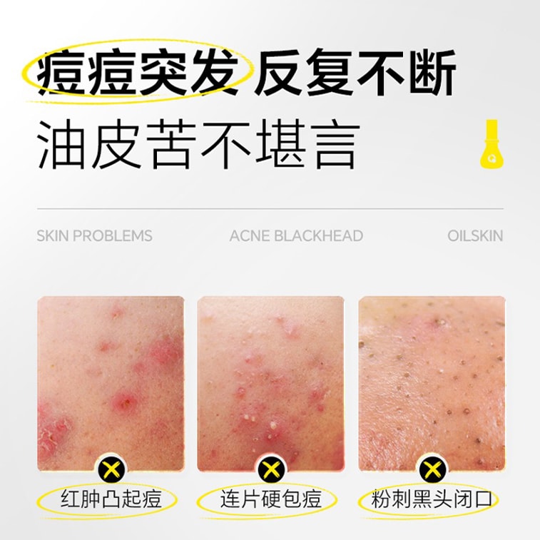 OKADY Oil Control Acne Essence Lotion 1 – 30ml | Sebum Balancing & Acne Treatment for Oily Skin